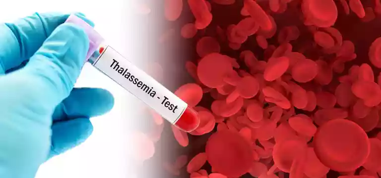 Thalassemia Profile Test - Purpose, Procedure & Price